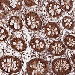Invitrogen MACROD1 Polyclonal Antibody 100 &mu;L; Unconjugated:Antibodies,