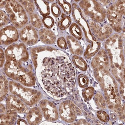 Invitrogen NCKAP5L Polyclonal Antibody 100 &mu;L; Unconjugated:Antibodies,