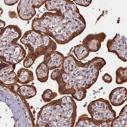 Invitrogen NCKAP5L Polyclonal Antibody 100 &mu;L; Unconjugated:Antibodies,