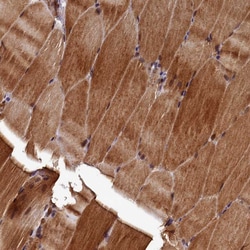 Invitrogen NCKAP5L Polyclonal Antibody 100 &mu;L; Unconjugated:Antibodies,