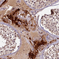 Invitrogen NCKAP5L Polyclonal Antibody 100 &mu;L; Unconjugated:Antibodies,