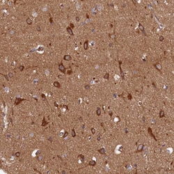 Invitrogen STX12 Polyclonal Antibody 100 &mu;L | Buy Online | Invitrogen&trade; | Fisher Scientific