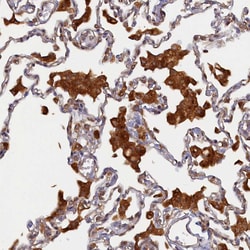 Invitrogen STX12 Polyclonal Antibody 100 &mu;L | Buy Online | Invitrogen&trade; | Fisher Scientific