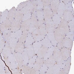 Invitrogen STX12 Polyclonal Antibody 100 &mu;L | Buy Online | Invitrogen&trade; | Fisher Scientific