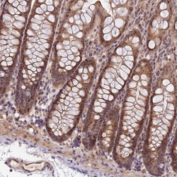 IMPACT Polyclonal Antibody:Antibodies, Polyclonal