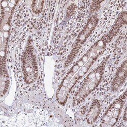 Invitrogen hnRNP U Polyclonal Antibody 100 &mu;L; Unconjugated:Antibodies,
