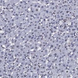 Invitrogen NPM2 Polyclonal Antibody 100 &mu;L; Unconjugated:Antibodies,