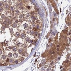 Invitrogen MKKS Polyclonal Antibody 100 &mu;L; Unconjugated:Antibodies,