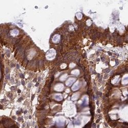 Invitrogen MKKS Polyclonal Antibody 100 &mu;L; Unconjugated:Antibodies,
