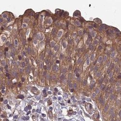 Invitrogen MKKS Polyclonal Antibody 100 &mu;L; Unconjugated:Antibodies,