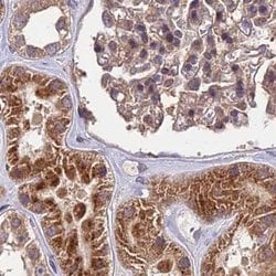Invitrogen MKKS Polyclonal Antibody 100 &mu;L; Unconjugated:Antibodies,