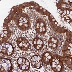 Invitrogen MKKS Polyclonal Antibody 100 &mu;L; Unconjugated:Antibodies,