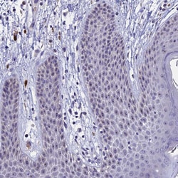 Invitrogen KNOP1 Polyclonal Antibody 100 &mu;L | Buy Online | Invitrogen&trade; | Fisher Scientific