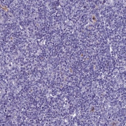Invitrogen KNOP1 Polyclonal Antibody 100 &mu;L | Buy Online | Invitrogen&trade; | Fisher Scientific