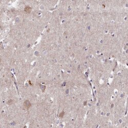 Invitrogen WDR59 Polyclonal Antibody 100 &mu;L; Unconjugated:Antibodies,