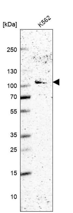 Invitrogen WDR59 Polyclonal Antibody 100 &mu;L | Buy Online | Invitrogen&trade; | Fisher Scientific