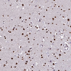 Invitrogen CPSF7 Polyclonal Antibody 100 &mu;L; Unconjugated:Antibodies,