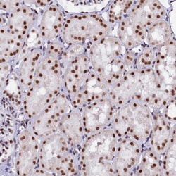 Invitrogen CPSF7 Polyclonal Antibody 100 &mu;L; Unconjugated:Antibodies,