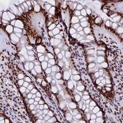 Invitrogen CPSF7 Polyclonal Antibody 100 &mu;L; Unconjugated:Antibodies,