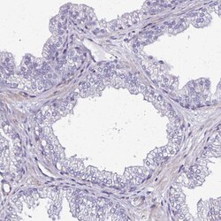 Invitrogen PLA2G4E Polyclonal Antibody 100 &mu;L; Unconjugated:Antibodies,