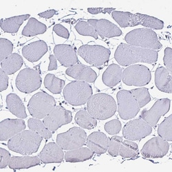 Invitrogen PLA2G4E Polyclonal Antibody 100 &mu;L; Unconjugated:Antibodies,