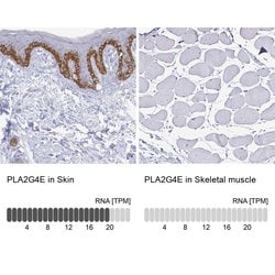 Invitrogen PLA2G4E Polyclonal Antibody 100 &mu;L; Unconjugated:Antibodies,