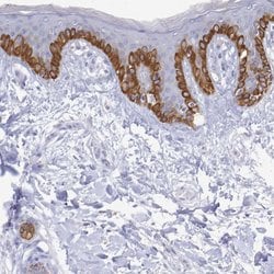 Invitrogen PLA2G4E Polyclonal Antibody 100 &mu;L; Unconjugated:Antibodies,