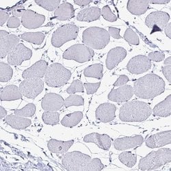 Invitrogen PLA2G4E Polyclonal Antibody 100 &mu;L; Unconjugated:Antibodies,