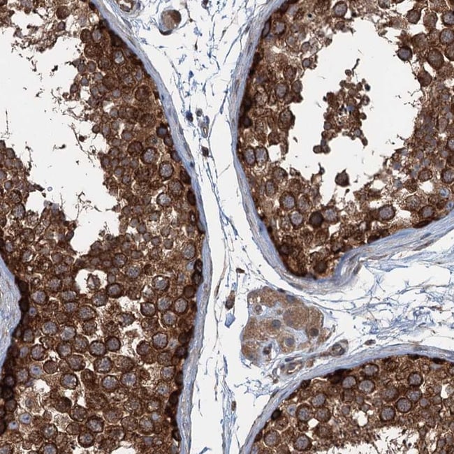 Trappc8 Inhibitor Invitrogen TRAPPC8 Polyclonal Antibody 100 μL | Buy Online | Invitrogen ...
