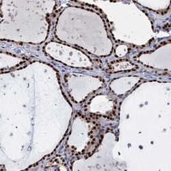 Invitrogen TSEN34 Polyclonal Antibody 100 &mu;L; Unconjugated:Antibodies,