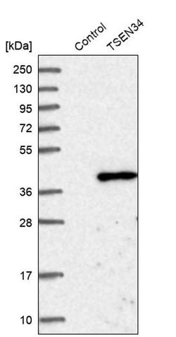 Invitrogen TSEN34 Polyclonal Antibody 100 &mu;L; Unconjugated:Antibodies,