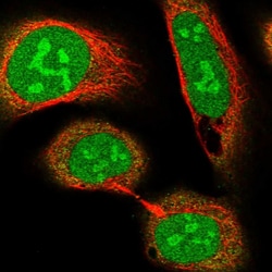 Invitrogen CCDC86 Polyclonal Antibody 100 &mu;L; Unconjugated:Antibodies,