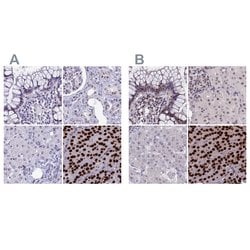 Invitrogen CCDC86 Polyclonal Antibody 100 &mu;L; Unconjugated:Antibodies,