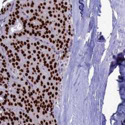 Invitrogen CCDC86 Polyclonal Antibody 100 &mu;L; Unconjugated:Antibodies,
