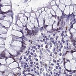 Invitrogen CCDC86 Polyclonal Antibody 100 &mu;L; Unconjugated:Antibodies,