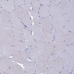 Invitrogen KCTD14 Polyclonal Antibody 100 &mu;L; Unconjugated:Antibodies,