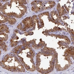 Invitrogen KCTD14 Polyclonal Antibody 100 &mu;L; Unconjugated:Antibodies,
