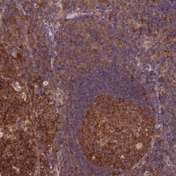 Invitrogen TRMT1 Polyclonal Antibody 100 &mu;L; Unconjugated:Antibodies,