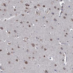 Invitrogen CTU2 Polyclonal Antibody 100 &mu;L; Unconjugated:Antibodies,