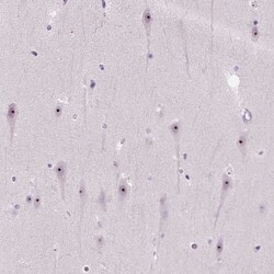 Invitrogen CIRH1A Polyclonal Antibody 100 &mu;L; Unconjugated:Antibodies,