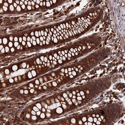 Invitrogen RPUSD1 Polyclonal Antibody 100 &mu;L; Unconjugated:Antibodies,