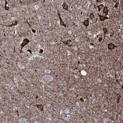 Invitrogen CR16 Polyclonal Antibody 100 &mu;L; Unconjugated:Antibodies,