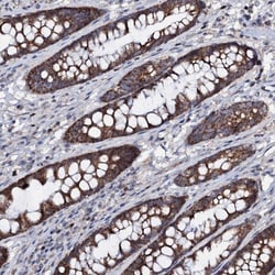 Invitrogen PPP1R3D Polyclonal Antibody 100 &mu;L; Unconjugated:Antibodies,