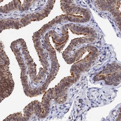 Invitrogen ANKEF1 Polyclonal Antibody 100 &mu;L; Unconjugated:Antibodies,