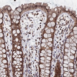 Invitrogen ANKEF1 Polyclonal Antibody 100 &mu;L; Unconjugated:Antibodies,
