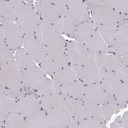 Invitrogen ANKEF1 Polyclonal Antibody 100 &mu;L; Unconjugated:Antibodies,