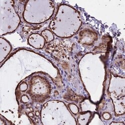 Invitrogen CHMP2A Polyclonal Antibody 100 &mu;L; Unconjugated:Antibodies,