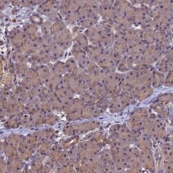 Invitrogen CHMP2A Polyclonal Antibody 100 &mu;L; Unconjugated:Antibodies,