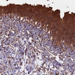 Invitrogen CHMP2A Polyclonal Antibody 100 &mu;L; Unconjugated:Antibodies,