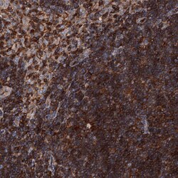 Invitrogen EDC4 Polyclonal Antibody 100 &mu;L | Buy Online | Invitrogen&trade; | Fisher Scientific
